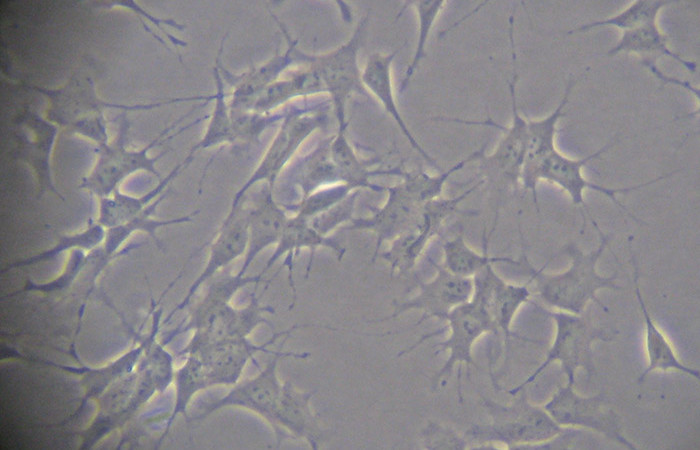 SHSY5Y cells
